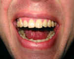 126-2628_IMG_2.jpg (34840 bytes)