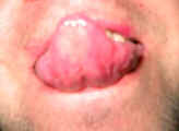 126-2631_IMG.jpg (20654 bytes)